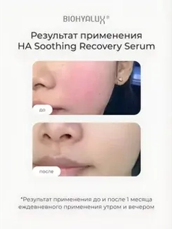 Сыворотка успокаивающая восстанавливающая с гиалуроновой кислотой | BIOHYALUX НА SOOTHING RECOVERY SERUM 30х1,5 мл