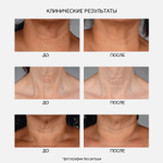 IS CLINICAL NeckPerfect Complex Интенсивный anti-age крем для шеи, 50 мл
