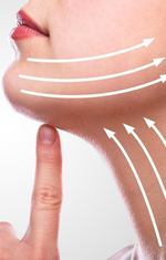 Французский лифтинг