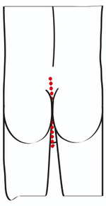Эрекционное кольцо с цепочкой для стимуляции ягодиц (Цвет: черный)