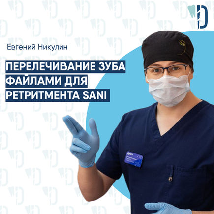 Перелечивание зуба файлами для ретритмента SANI