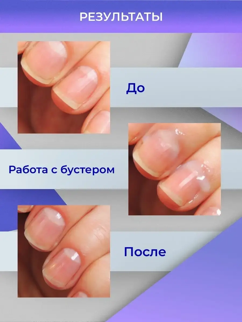 Multi Booster Мульти Бустер для стоп и ногтей 100 мл