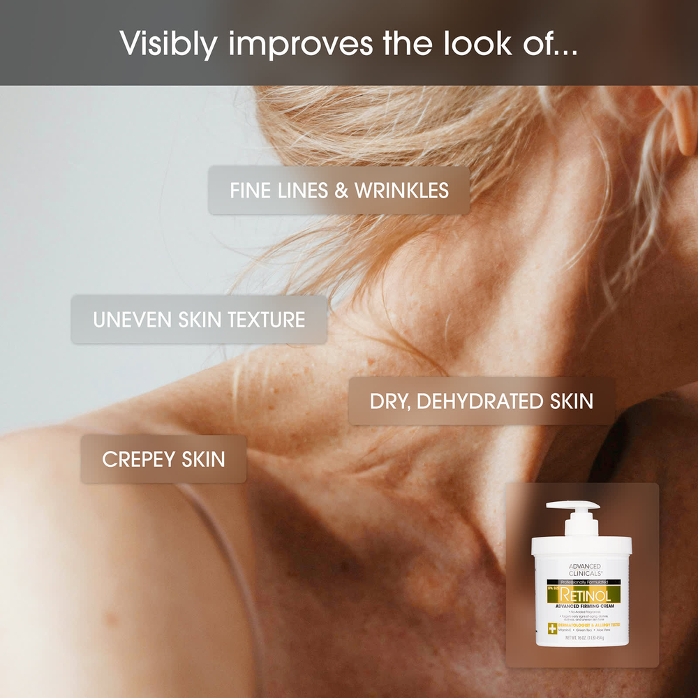 Advanced Clinicals, Retinol, укрепляющий крем с улучшенной формулой, 454 г (16 унций)