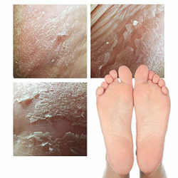 Elizavecca Witch Piggy Hell Pore Turtle's Foot Pack отшелушивающие пилинг-носочки