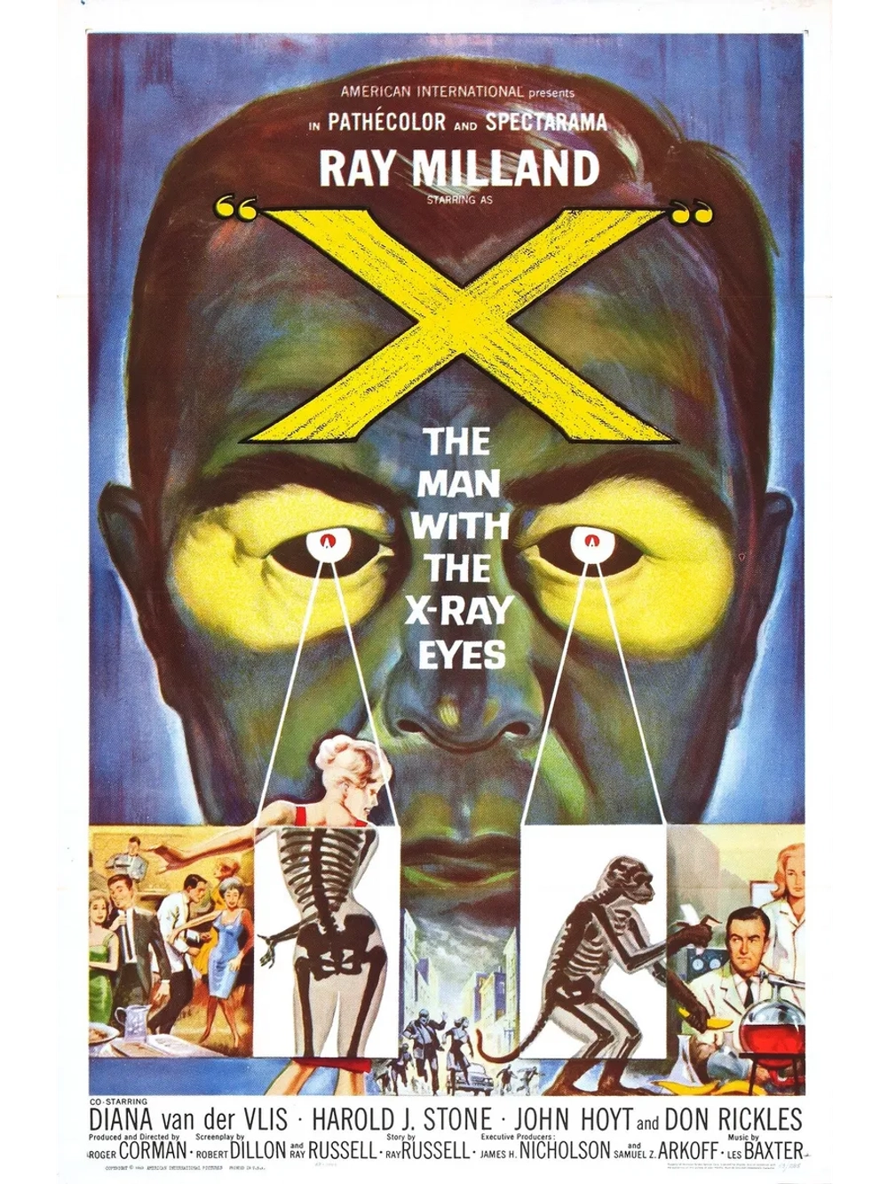 Человек с рентгеновскими глазами (1963) (DVD-R)