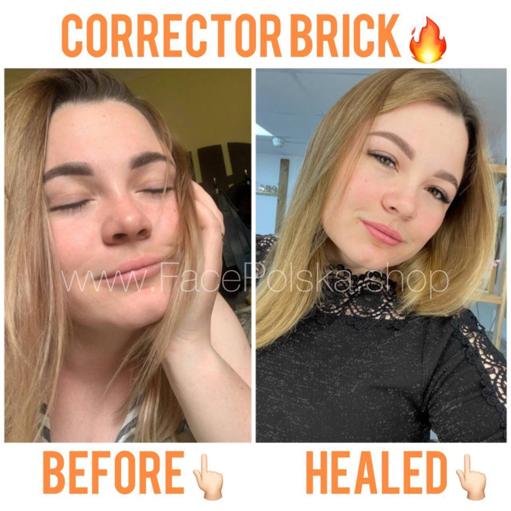 Corrector BRICK
