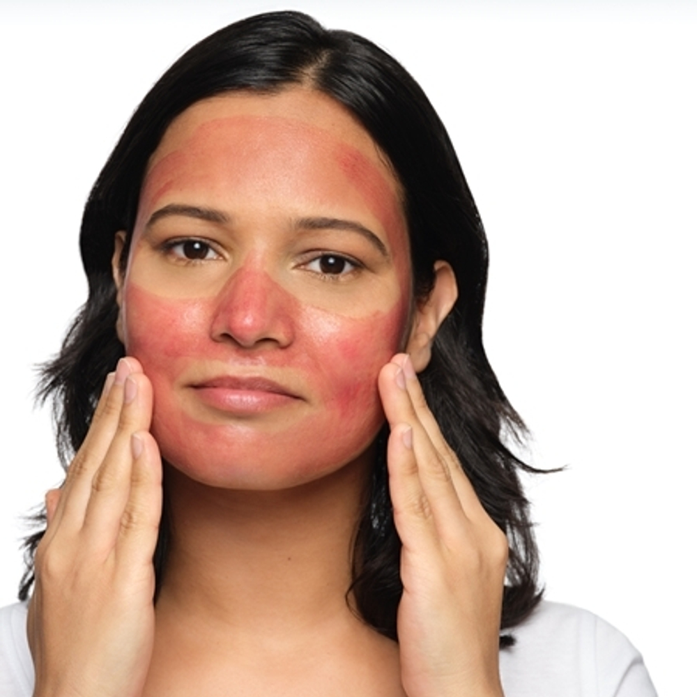 Пилинг-раствор AHA 30% + BHA 2% раствор с отшелушивающим эффектом 30 мл