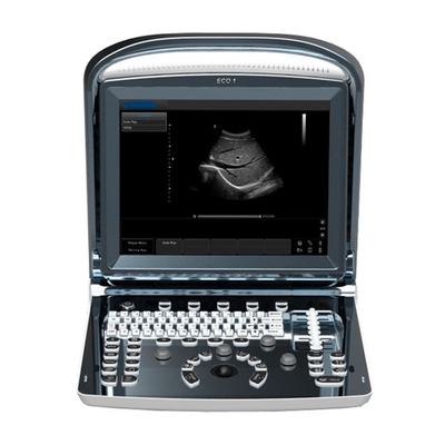 Ультразвуковой аппарат Chison SonoTouch 10