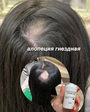 Активатор роста волос Limba Activator Vitamin B  АКЦИЯ!