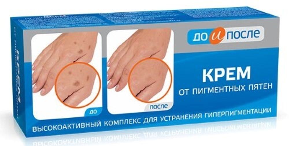 Крем от пигментных пятен, 50г