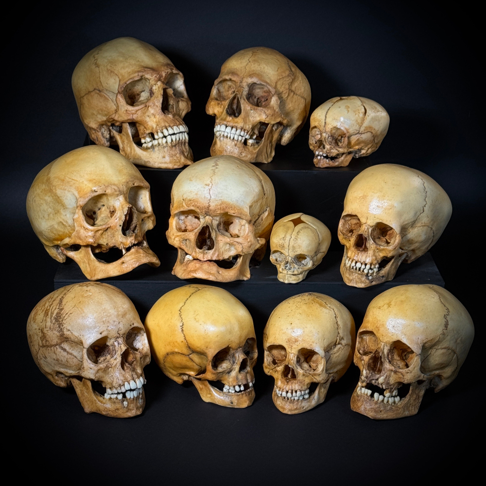 Набор «Череп человека» (анатомические модели)
