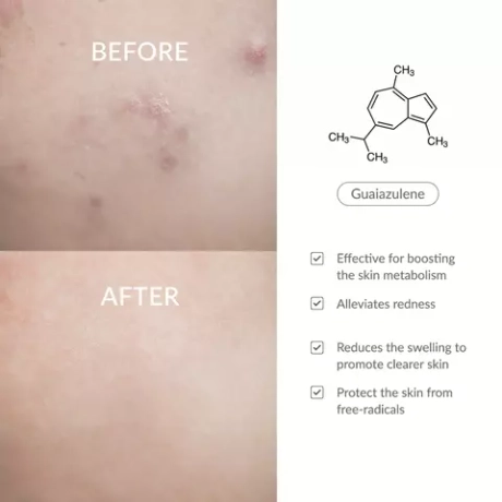 Крем для лица Dr.Althea Pro Lab Azulene 147HA Intensive Soothing Cream 50 мл