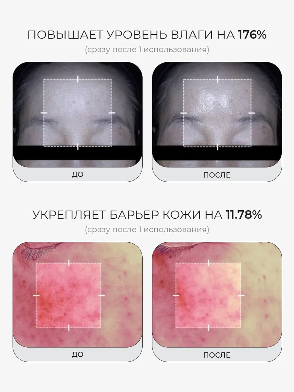 Medicube Сыворотка с микроиглами, ПДРН и экзосомами против морщин и пигментации PDRN Pink Collagen Exosome Shot 7500 30 мл