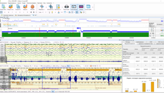 АМБУЛАТОРНАЯ ПСГ С ВИДЕОРЕГИСТРАЦИЕЙ (ТИП II)
