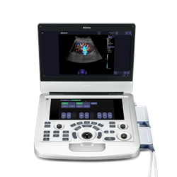 УЗИ аппарат Edan Acclarix AX3