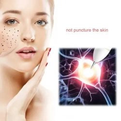 Иголки для лазерной ручки от папиллом и бородавок /10 штук