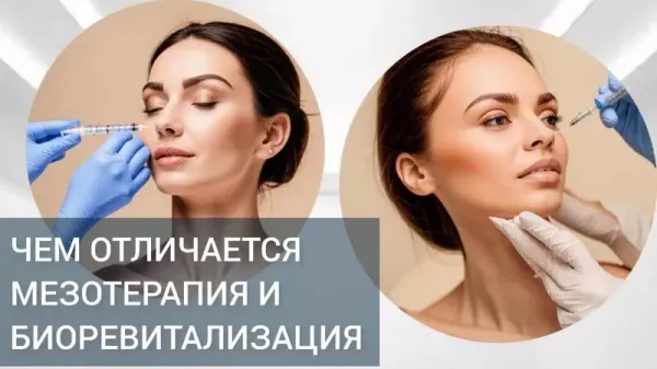 Мезотерапия или Биоревитализация?