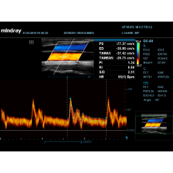 Аппарат УЗИ (сканер) Mindray DC-55