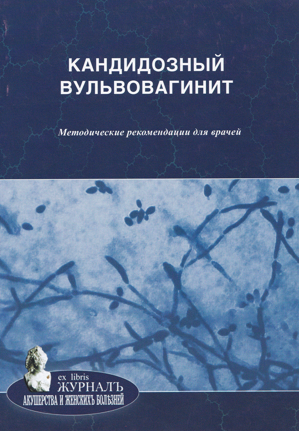 Кандидозный вульвовагинит: методические рекомендации для врачей