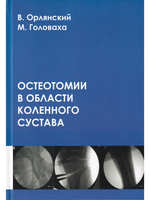 Остеотомии в области коленного сустава