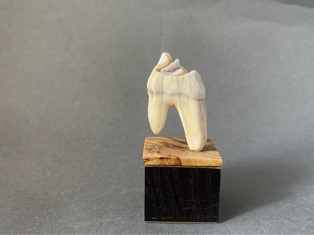 Зуб мудрости