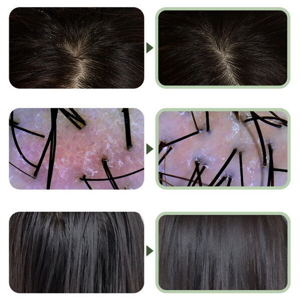 Средство для очищения кожи головы с мятой и экстрактом чайного дерева Esthetic House CP-1 Tee Tree Mint Scaler, 120мл