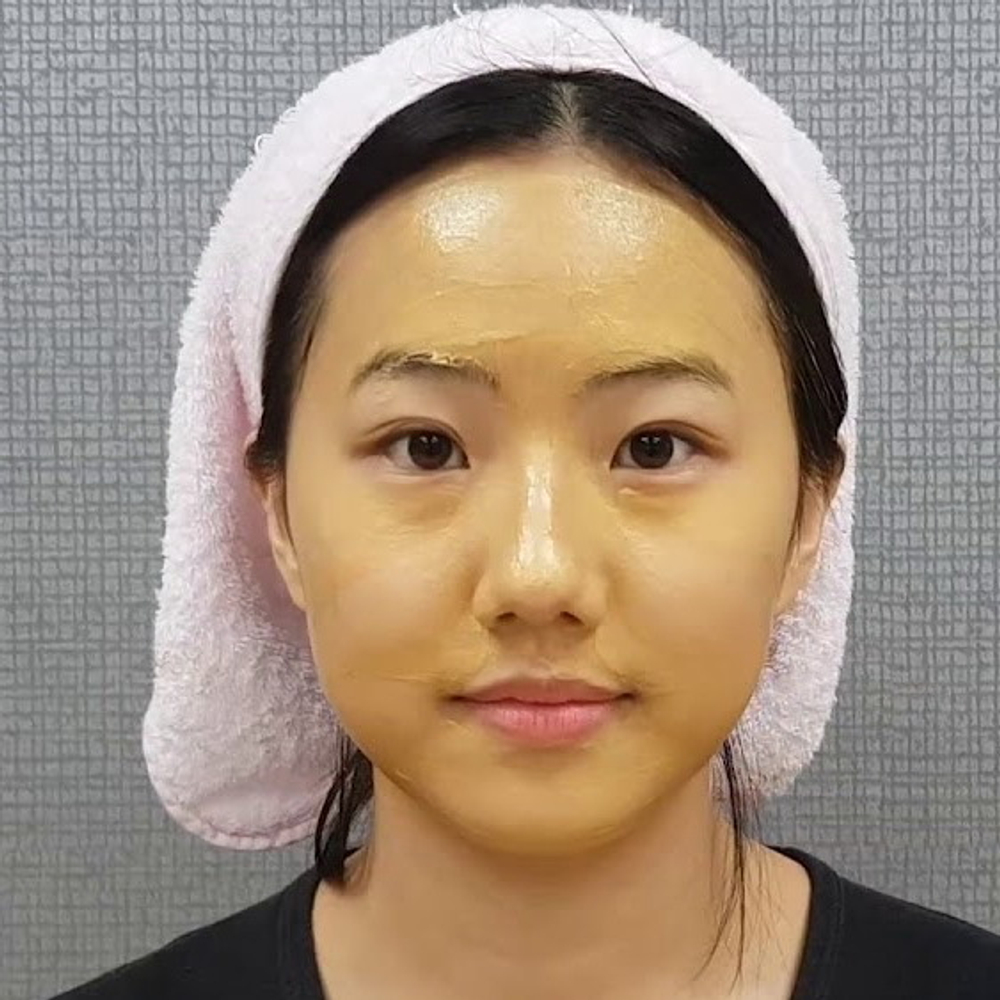 Princess Peel Storyderm | Пилинг для эластичности кожи с микроиглами