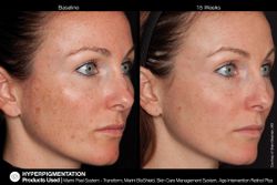 JAN MARINI AGE INTERVENTION RETINOL+ 0,5% Крем-акселератор с ретинолом 0,5% для борьбы с видимыми возрастными изменениями