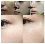 MEDI-PEEL  Гель для глубокого очищения кожи с эффектом детокса 2 в 1
