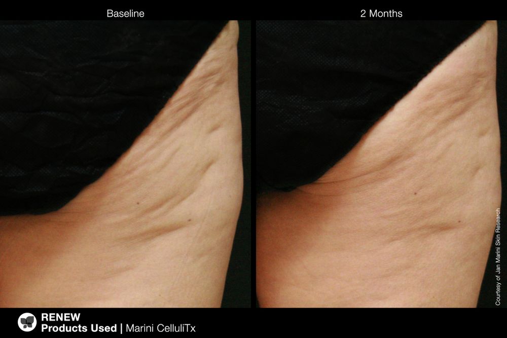 JAN MARINI CELLULITX Высокоэффективный антицеллюлитный крем