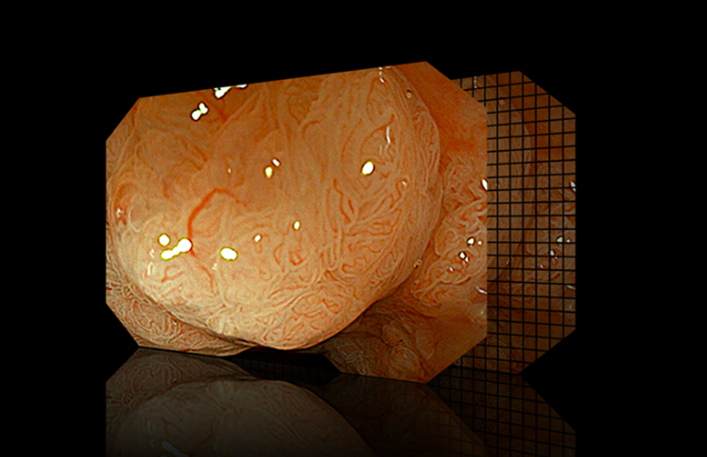 Видеоэндоскопическая система Aohua AQ-200