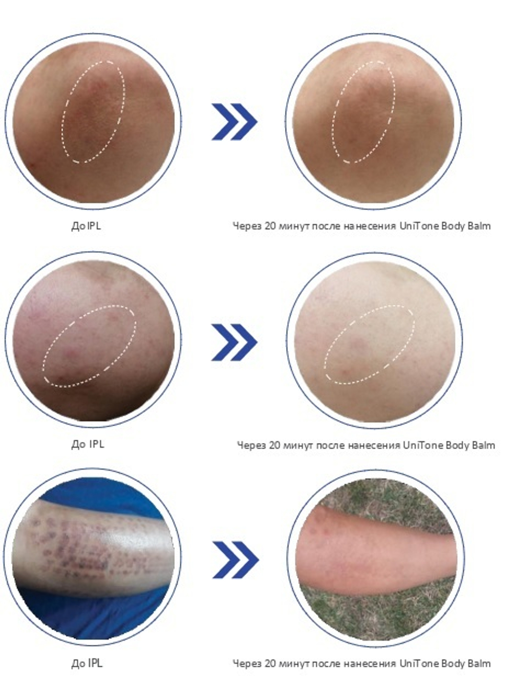 Skin Tone Neuro Body Balm - Осветляющий бальзам для тела ,200 мл