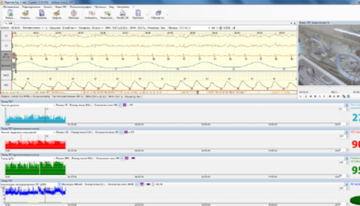 МОНИТОРИНГ ЦЕРЕБРАЛЬНОЙ ФУНКЦИИ
