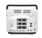 УЗИ аппарат SonoScape E2