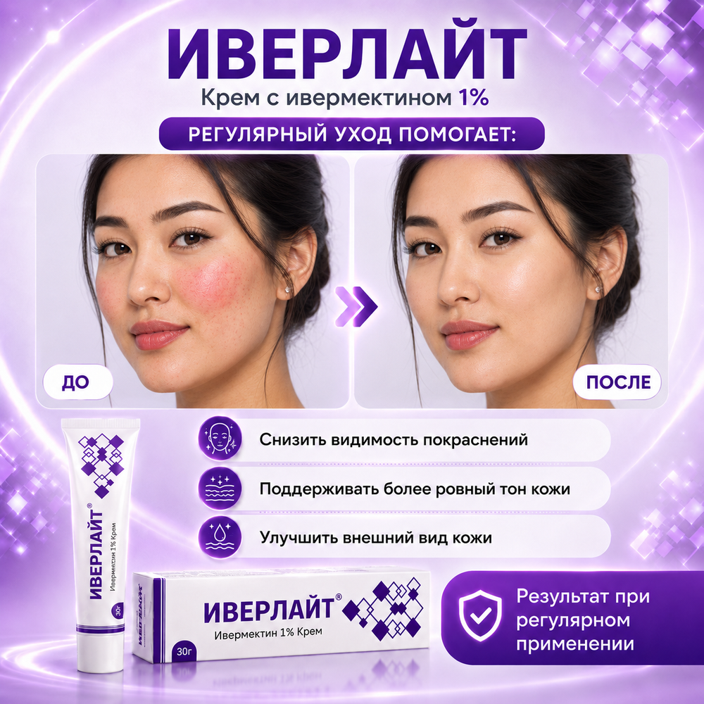 ИВЕРЛАЙТ кремі