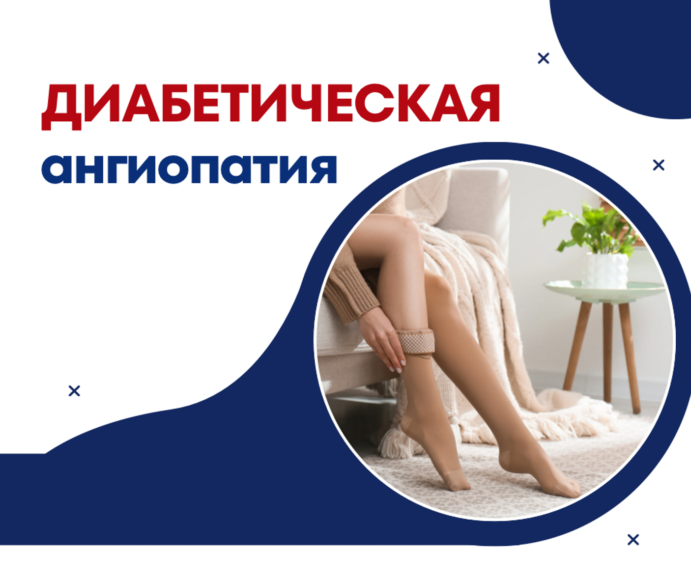 Компрессионный трикотаж при диабетической ангиопатии