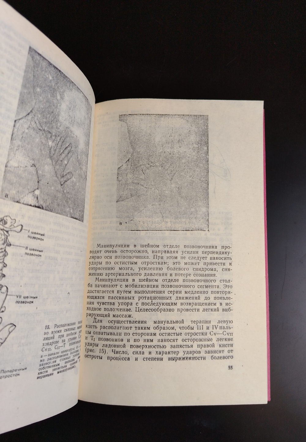 Книга Мануальная терапия при остеохандрозе позвоночника Н А Касьян Самиздат Новая  XF