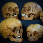 Набор «Череп человека» (анатомические модели)