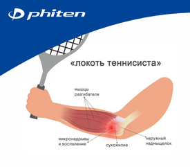 Локоть теннисиста: почему болит рука и как помочь себе без операции