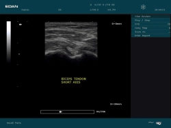 Аппарат УЗИ Edan DUS 60 (без УЗИ датчиков)