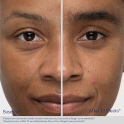 Obagi Medical Сыворотка бустер для роста бровей NU-CIL Eyebrow Boosting Serum 5 мл