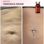 Drain Veronica