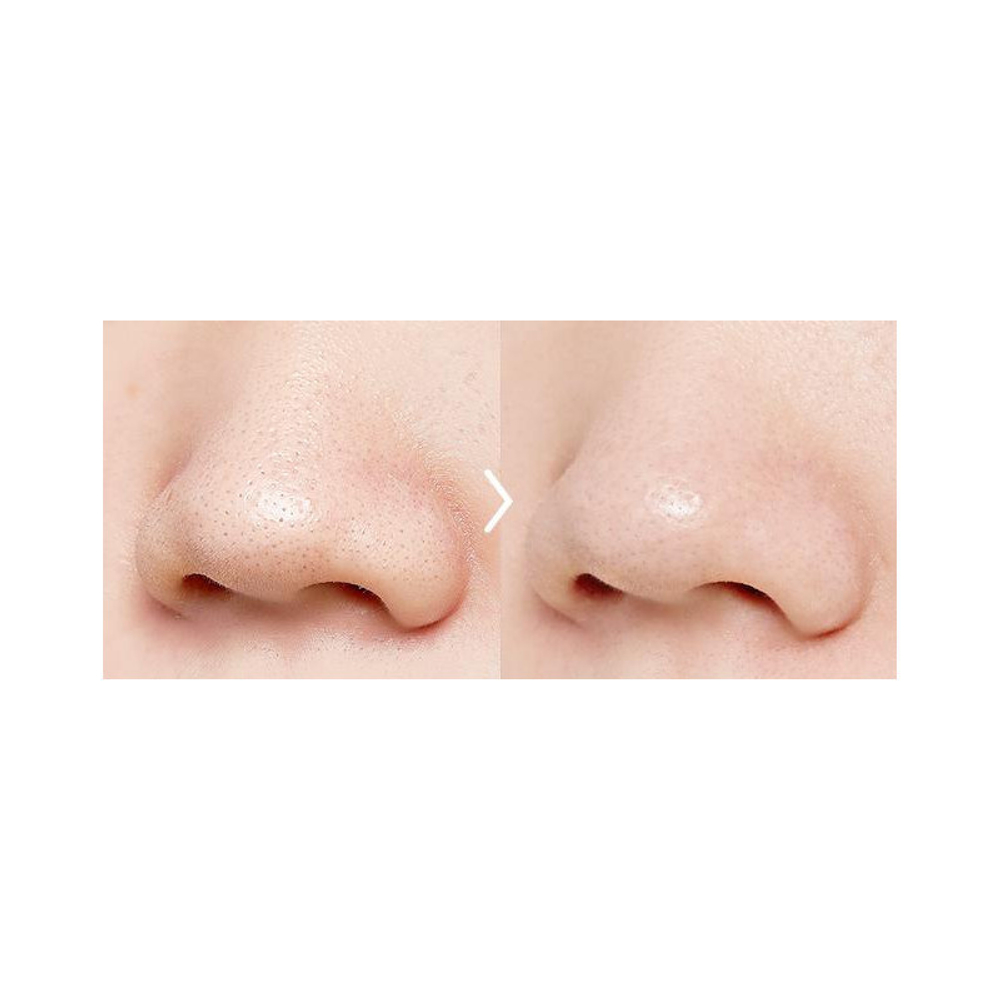 A'Pieu Goblin Blackhead Peeling Pad пилинг-диски от черных точек
