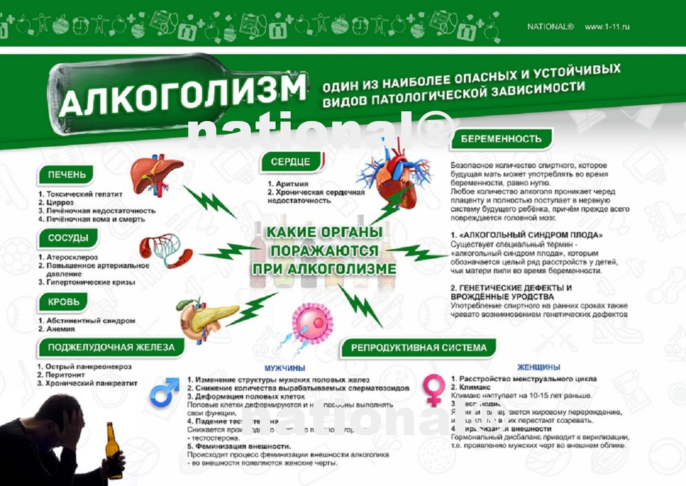 Плакат А4 (один из пяти) комплекта оборудования ЗОЖ National®