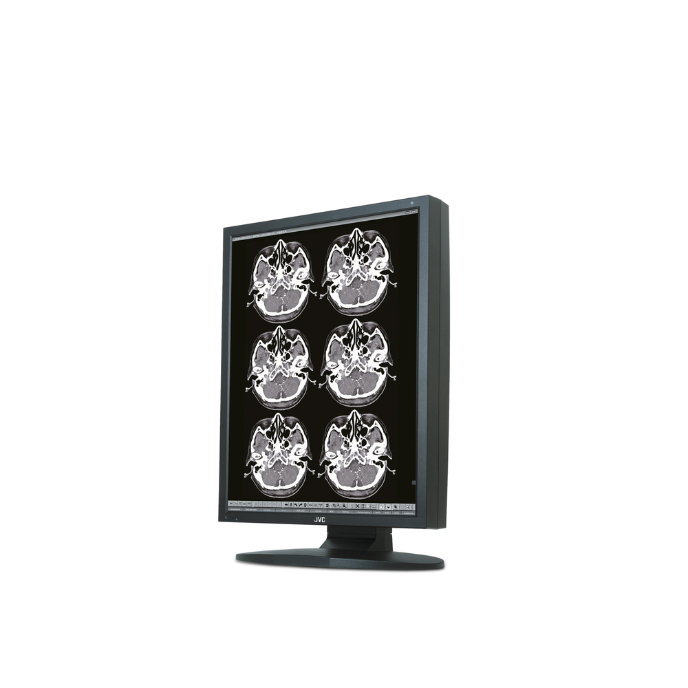 Медицинский монитор JVC MS25i2