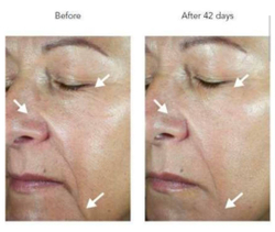 Новинка ! BIJOU DE MER DDS RD Capsule - капсульная омолаживающая эссенция, 30 шт.