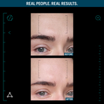 ALLIES OF SKIN Multi Peptides & GF Advanced Lifting Serum Разглаживающая мультипептидная сыворотка с фактором роста, 50 мл
