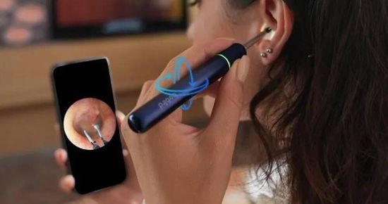 Умная ушная палочка Bebird Ear Visual Picking Stick Note 5 Pro