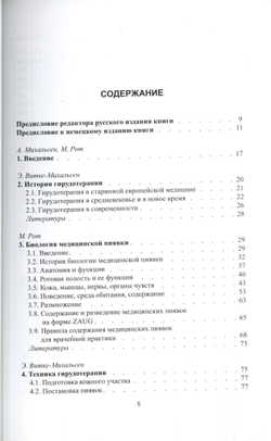 Лечение медицинскими пиявками
