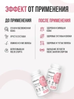 Collagen 1 & 3